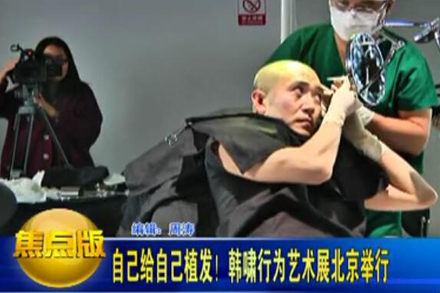 Lifeboo: Hair Transplantation to myself:Xiao Han’s Performi